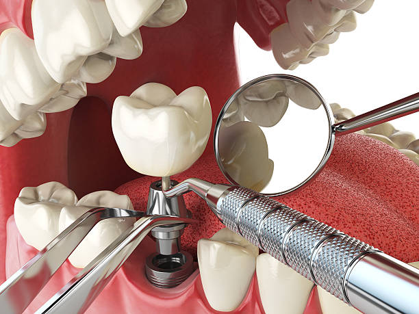 Best Emergency Gum Treatment in Townsend, DE